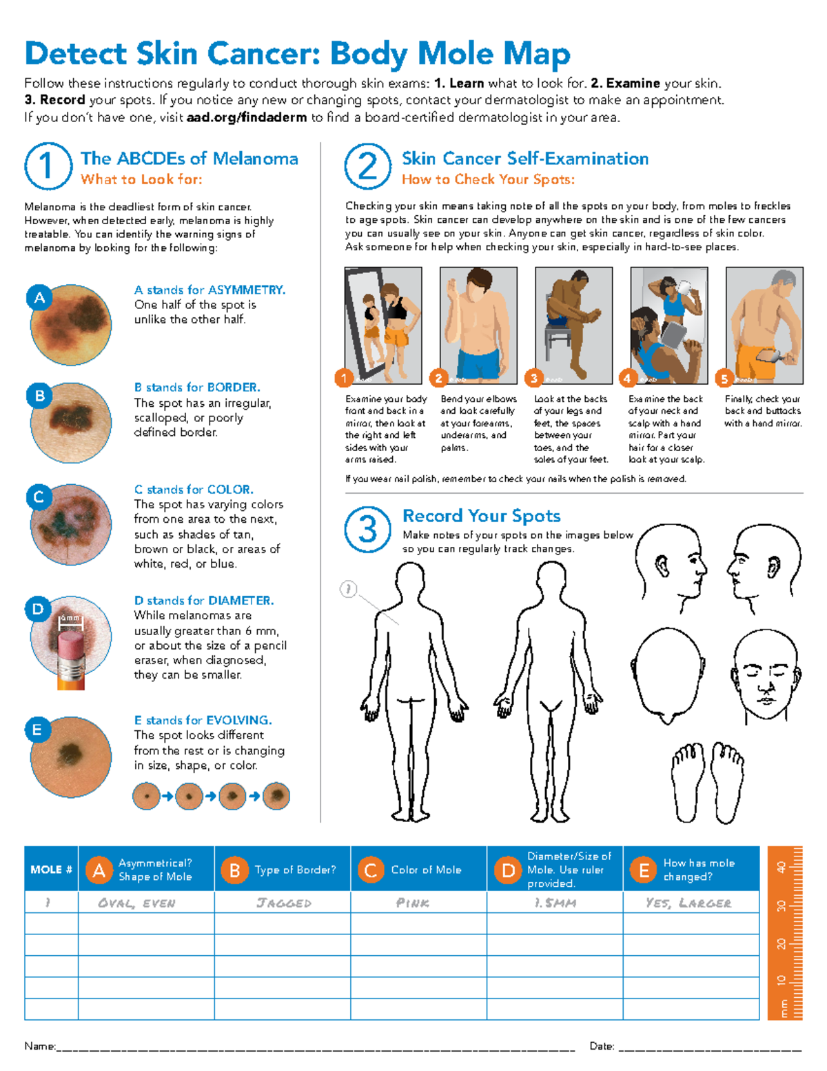 Body Mole Mapping And Melanoma Detection Guidelines Studocu